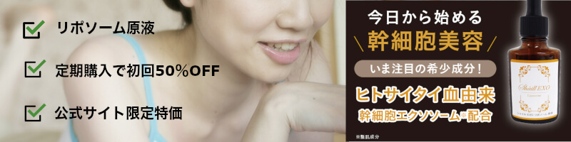 �V���C��EXO���|�\�[�����t���T�C�g